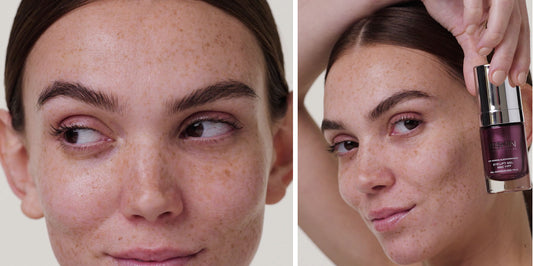 A Step-by-Step Guide on How to Apply Eye Cream