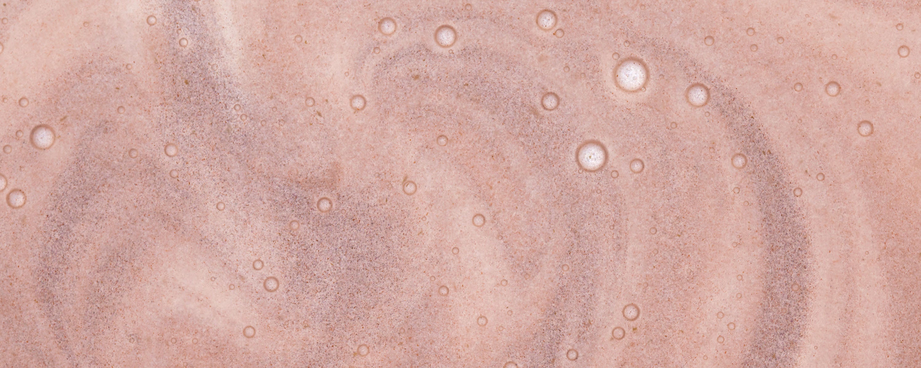 The Skin Science of Diglucosyl Gallic Acid