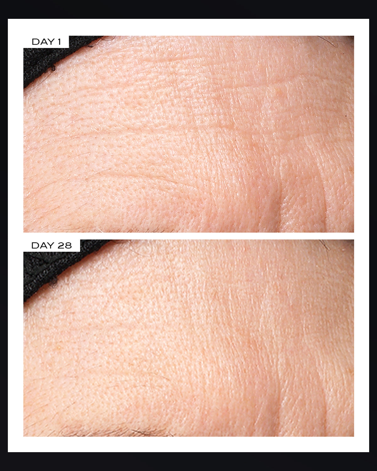 Exosome Face Lift