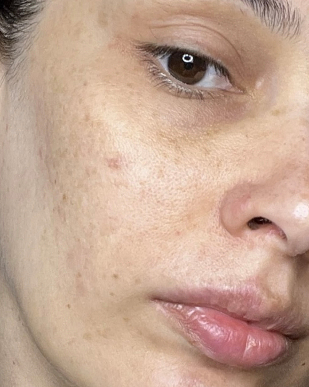 Repair Serum NAC Y²™
