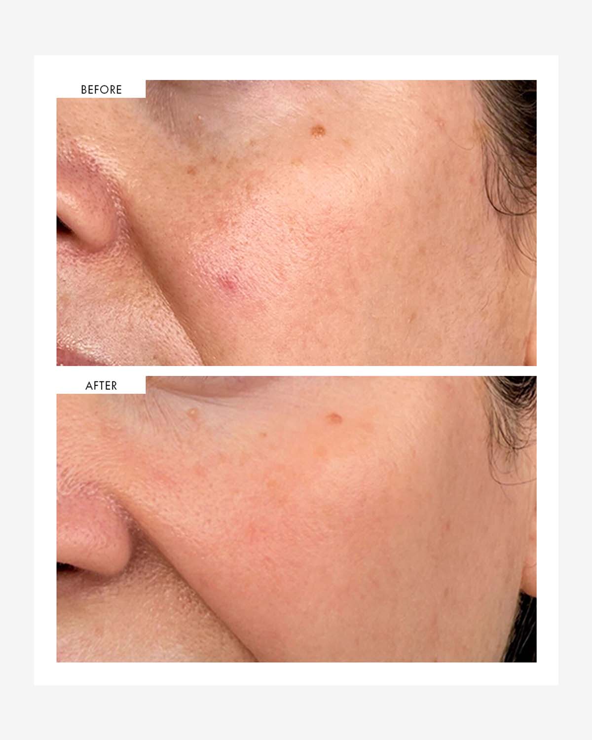 Dark Spot Correcting Serum