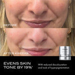 Precision Peel